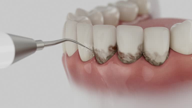 Reliable Teeth Cleaning And Checkup contractor in Gratiot County County, MI by Dentist Open Now